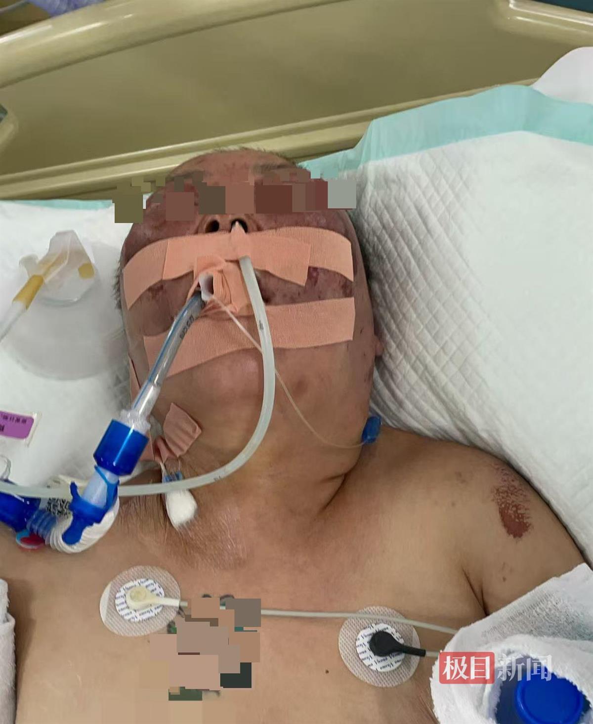九游体育-被前夫打进ICU的女子情况仍不稳定，其8岁女儿也曾遭父亲扇脸，律师：已构成故意伤害罪，或同时涉虐待罪